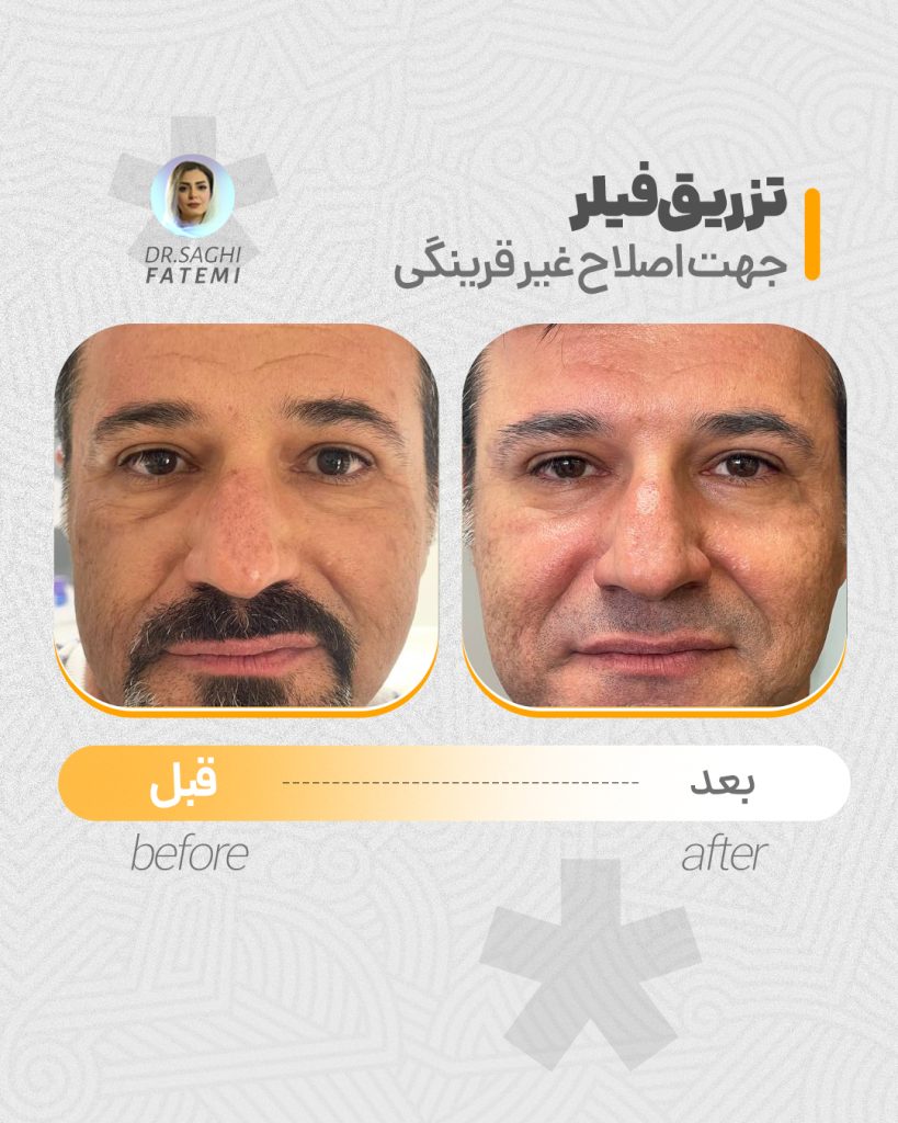 قبل-و-بعد_01