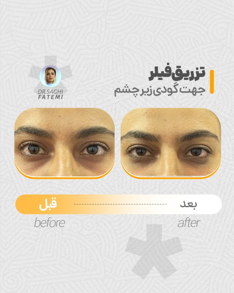 قبل-و-بعد_02