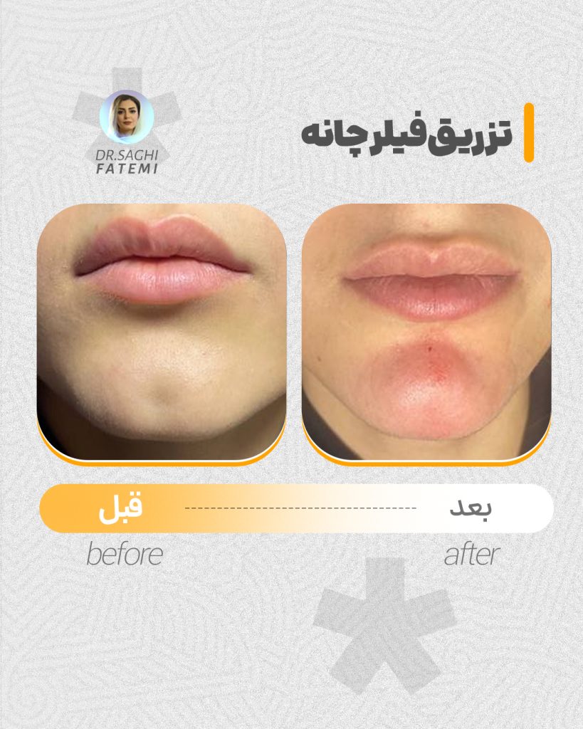 قبل-و-بعد_03