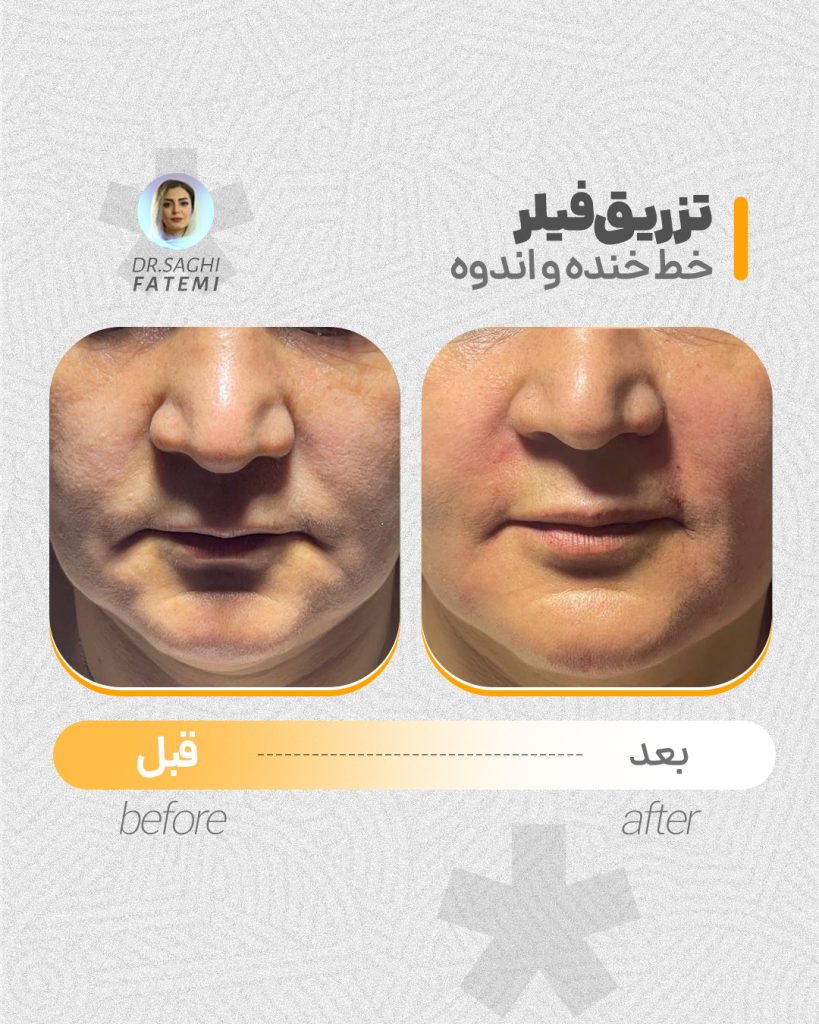قبل-و-بعد_04