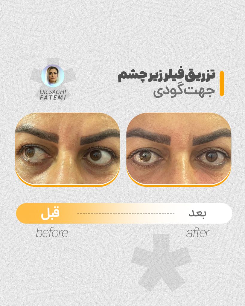 قبل-و-بعد_06