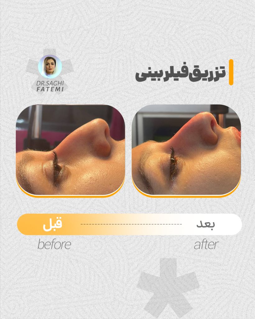 قبل-و-بعد_08