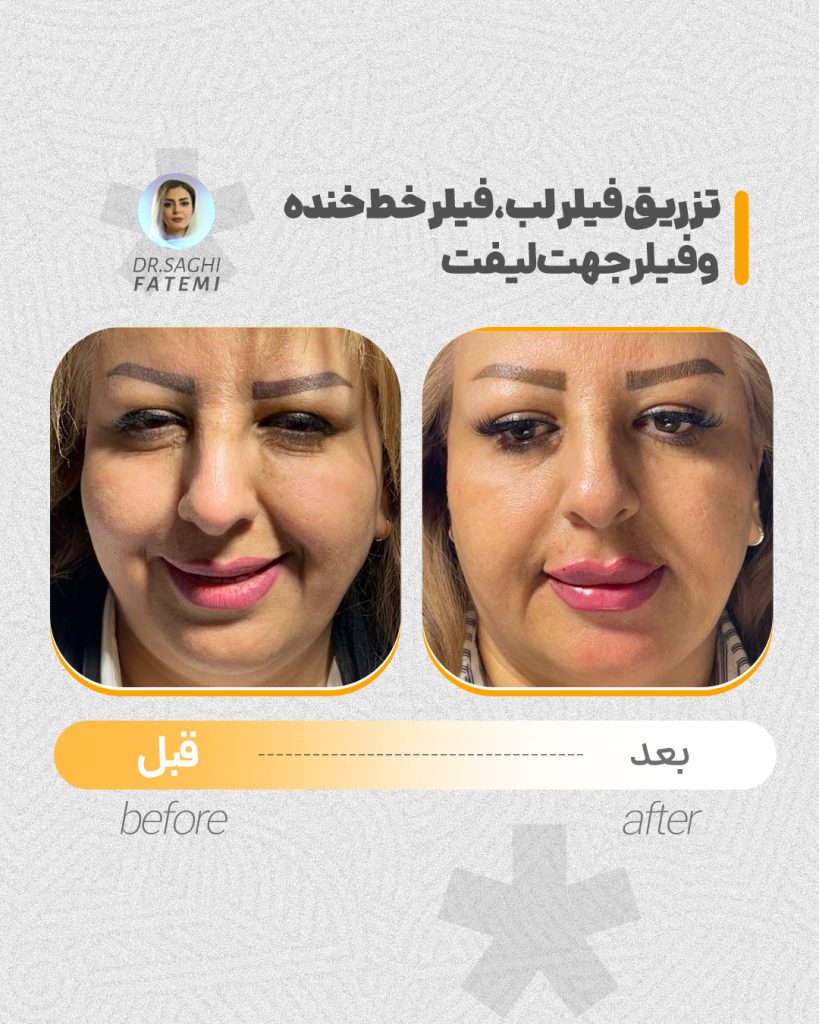 قبل-و-بعد_10