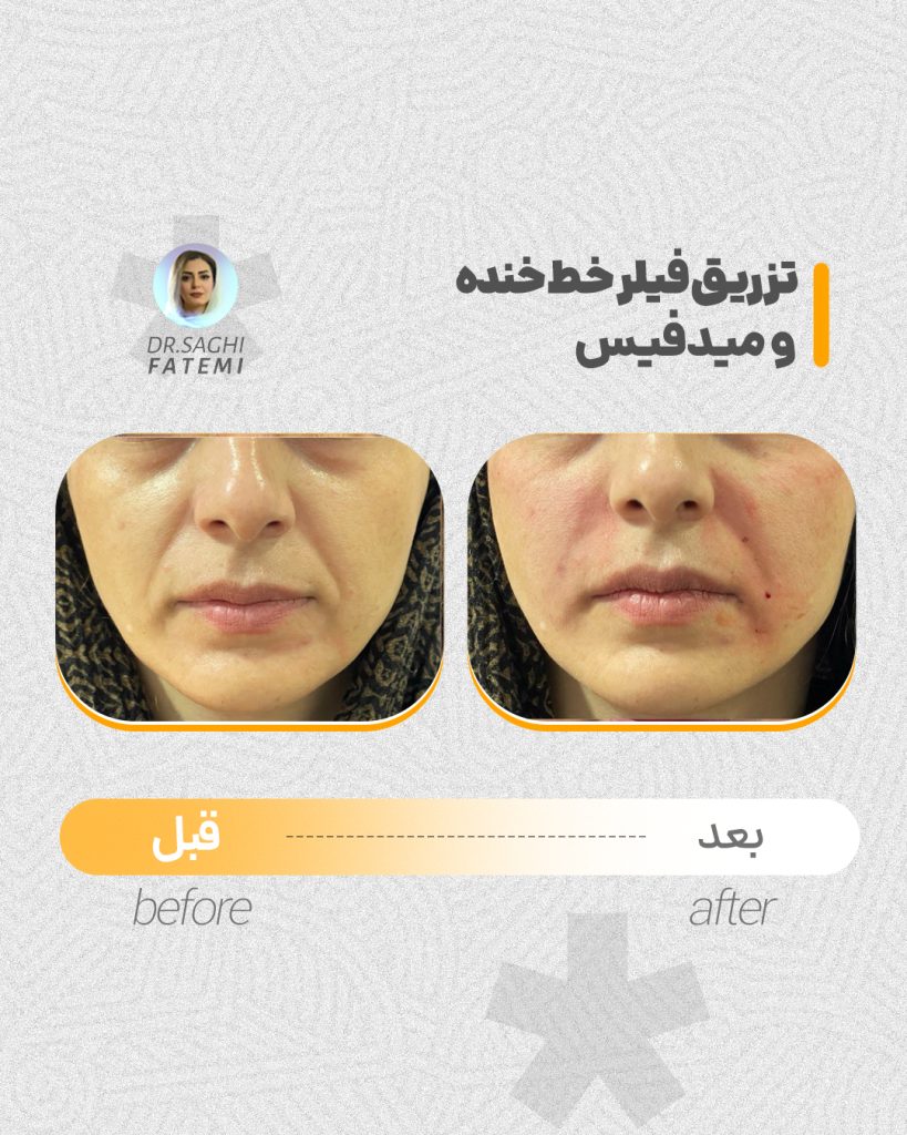 قبل-و-بعد_11