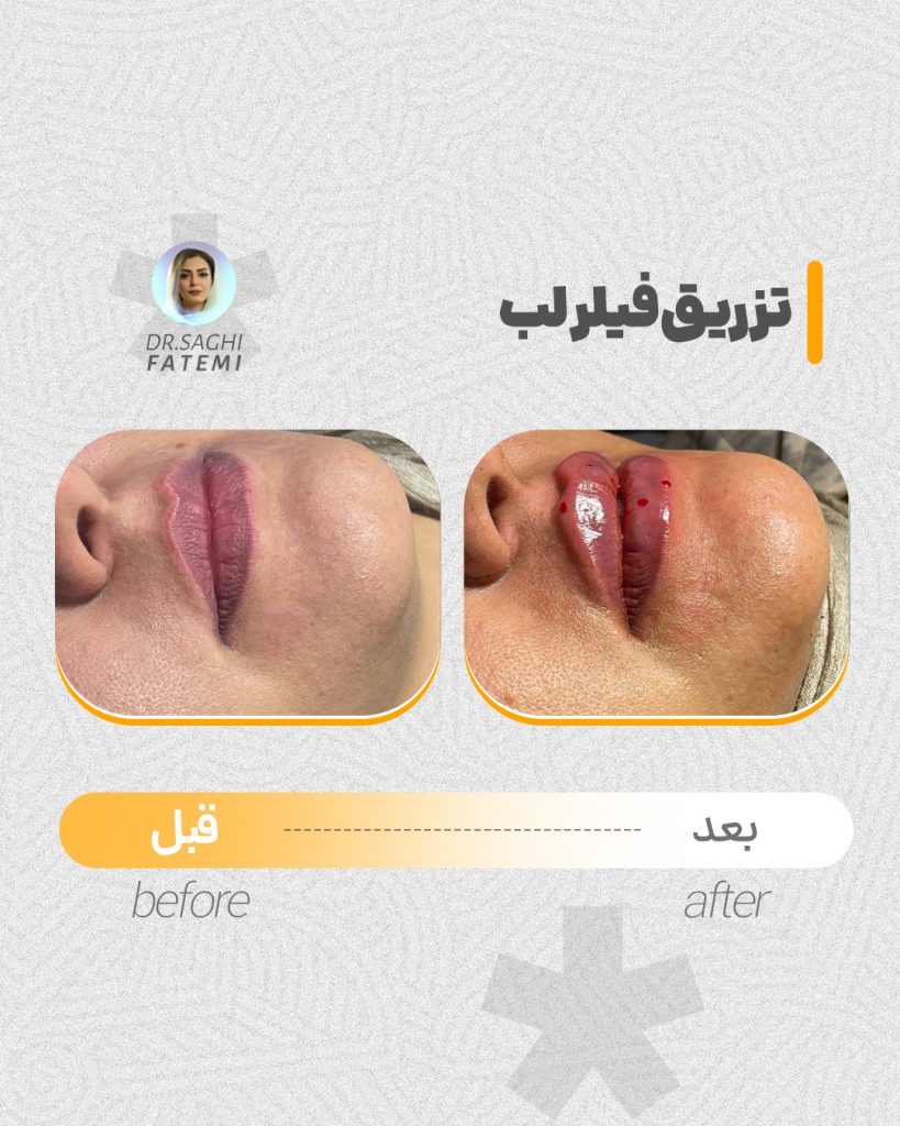 قبل-و-بعد_12