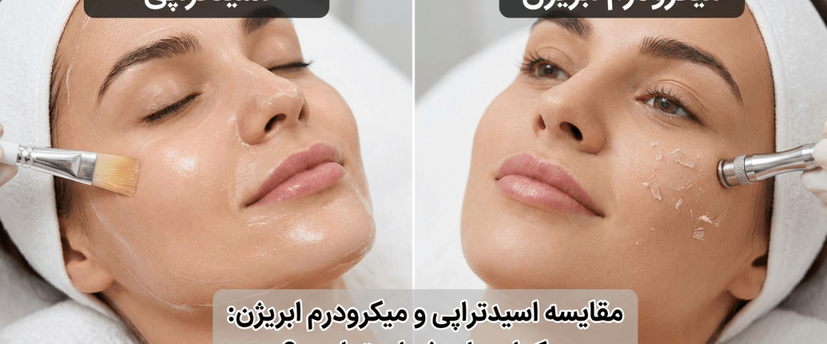مقایسه اسیدتراپی و میکرودرم ابریژن