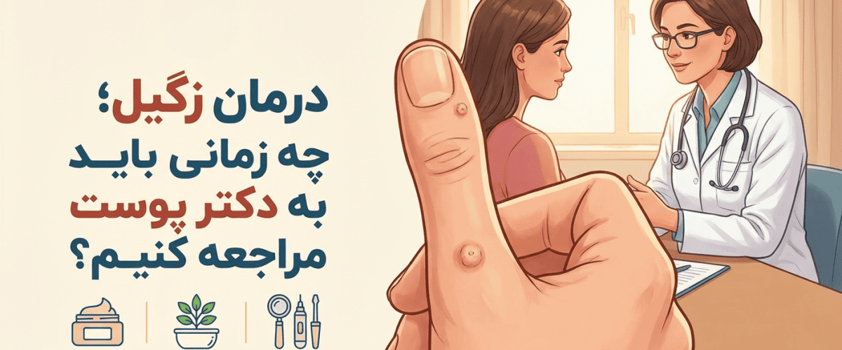 درمان زگیل در اصفهان