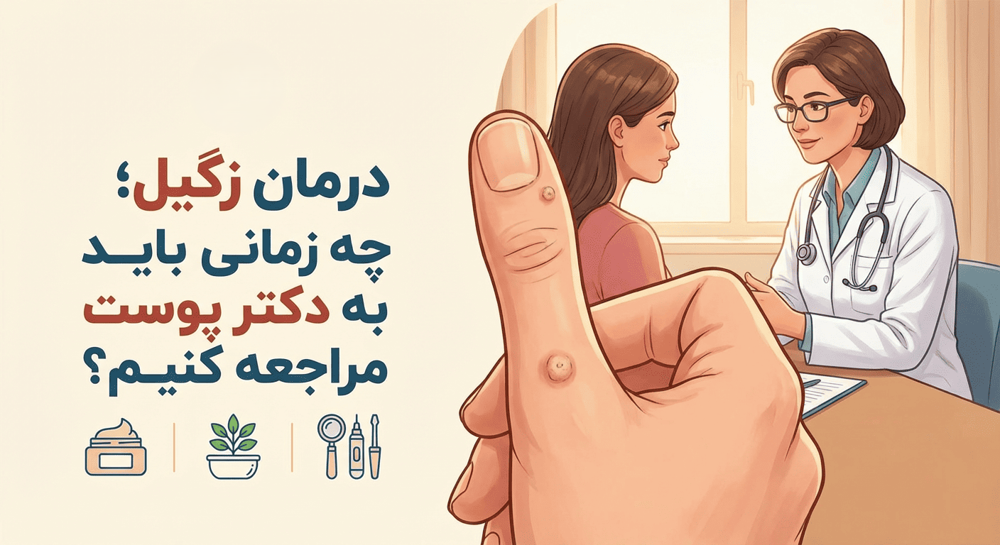 درمان زگیل در اصفهان