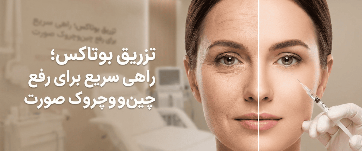 تزریق بوتاکس؛ راهی سریع برای رفع چین‌وچروک صورت در اصفهان