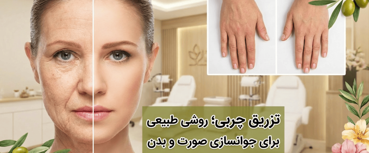 تزریق چربی