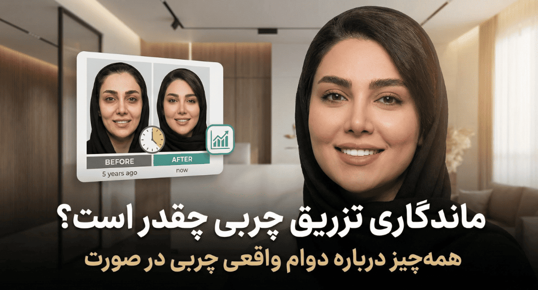 ماندگاری تزریق چربی