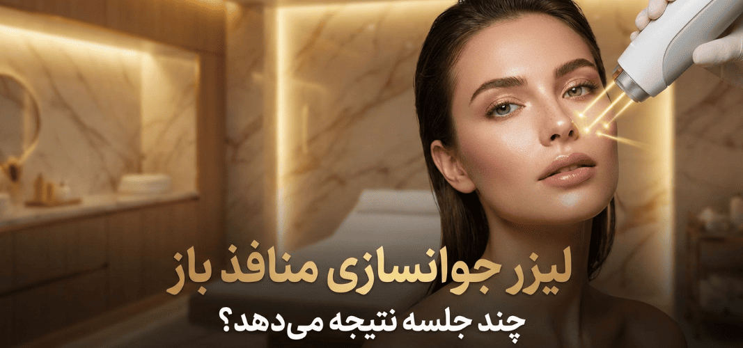 لیزر منافذ باز