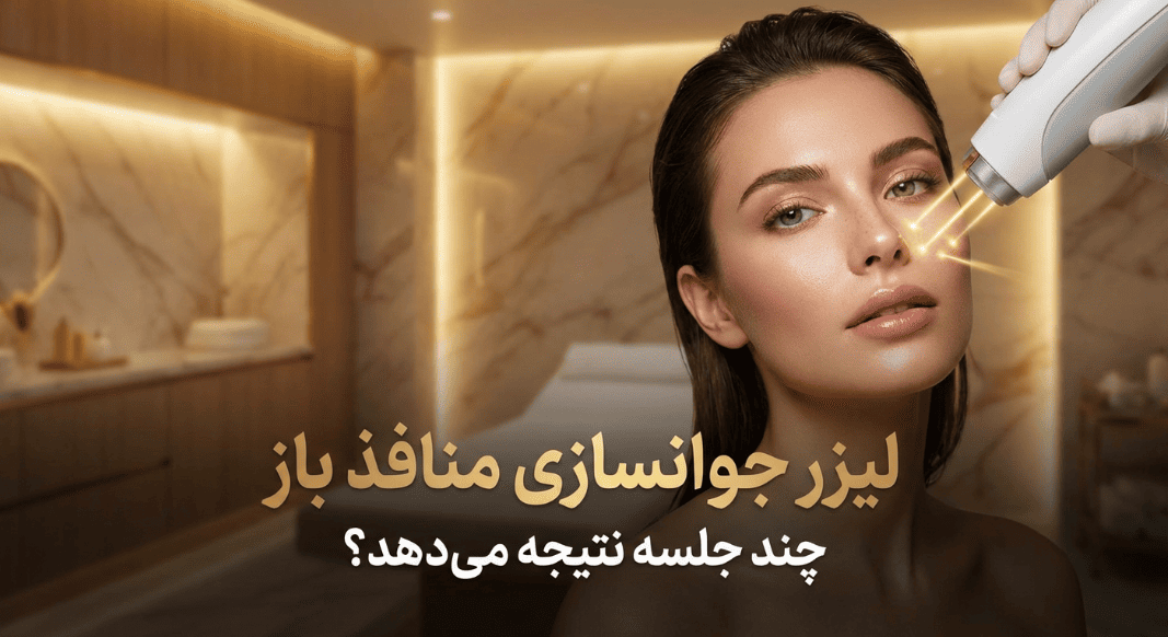 لیزر منافذ باز