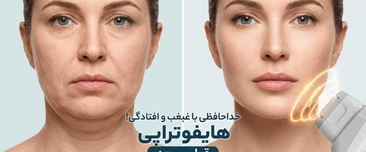 تصویر شاخص برای مقاله رفع غبغب با هایفو | خداحافظی با غبغب و افتادگی!