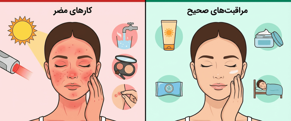 مراقبت بعد از لیزر جوانسازی