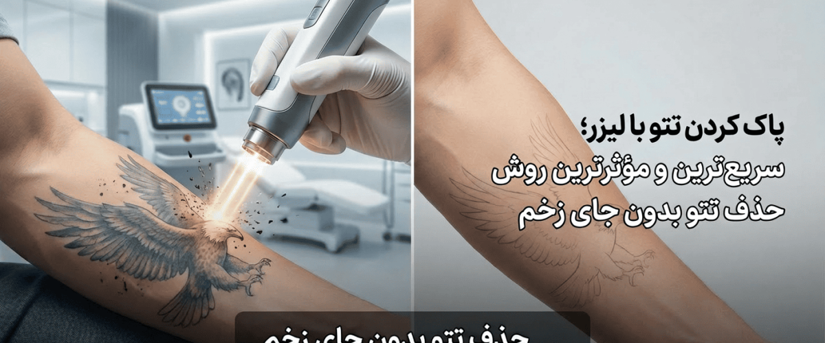 پاک کردن تتو با لیزر؛ سریع‌ترین و مؤثرترین روش حذف تاتو بدون جای زخم