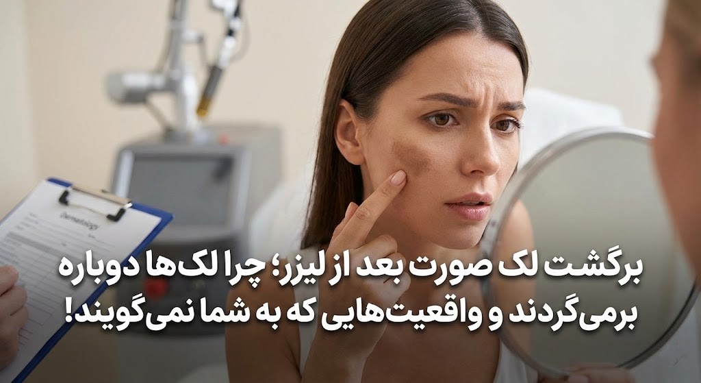 برگشت لک صورت بعد از لیزر