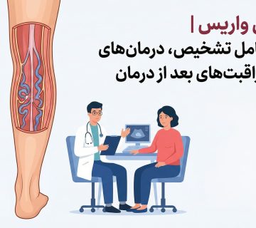 متخصص واریس اصفهان | راهنمای کامل تشخیص، درمان‌های جدید و مراقبت‌های بعد از درمان