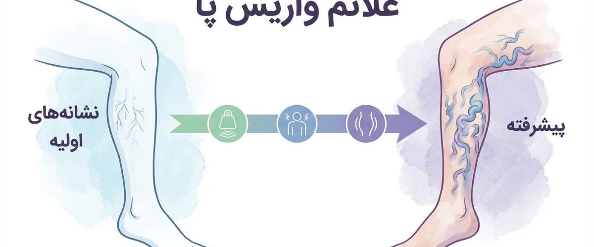 علائم واریس پا | نشانه‌های اولیه تا پیشرفته