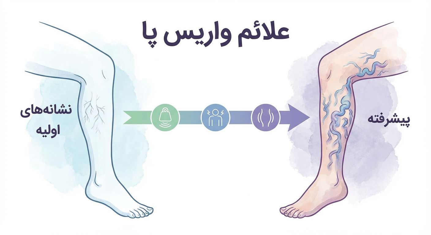 علائم واریس پا | نشانه‌های اولیه تا پیشرفته