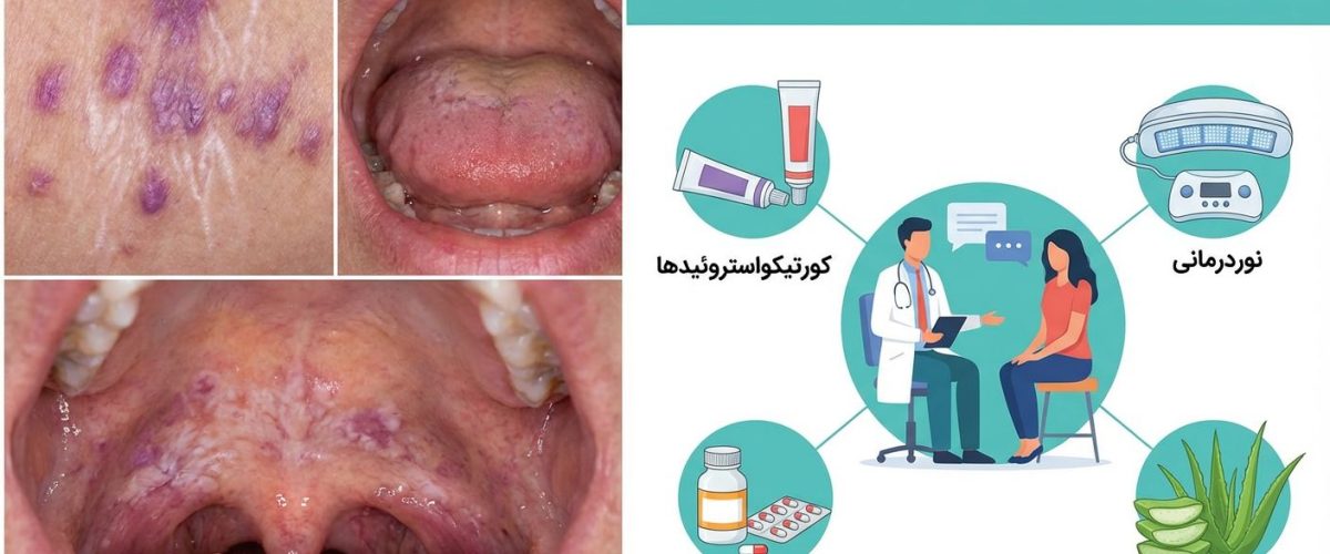 درمان لیکن پلان در اصفهان | روش‌های نوین و مؤثر در کلینیک دکتر ساقی فاطمی