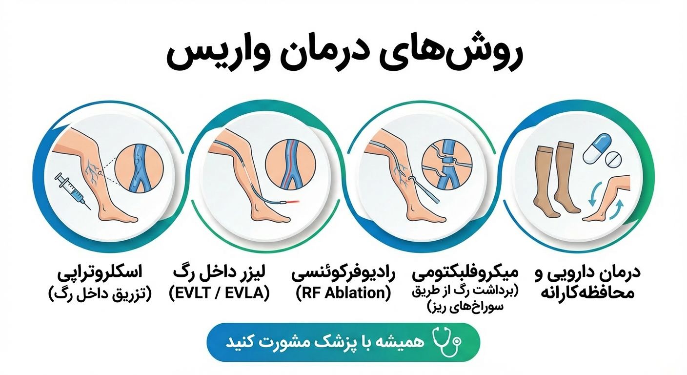 روش های درمان واریس