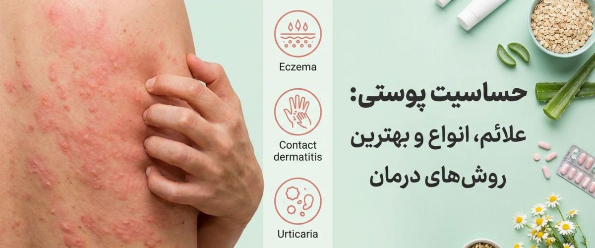 حساسیت پوستی چیست؟ علائم، انواع و بهترین روش‌های درمان