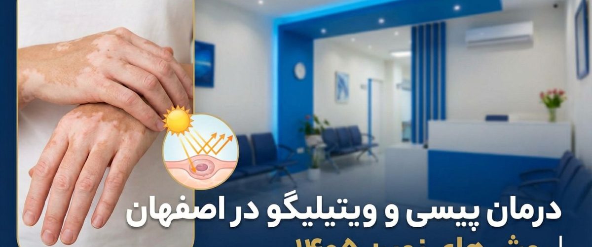 درمان پیسی و ویتیلیگو در اصفهان با جدیدترین روش‌های ۱۴۰۵ شامل فتوتراپی، لیزر اگزایمر و پیوند ملانوسیت در کلینیک دکتر ساقی فاطمی. مشاوره رایگان و نوبت‌دهی آنلاین.
