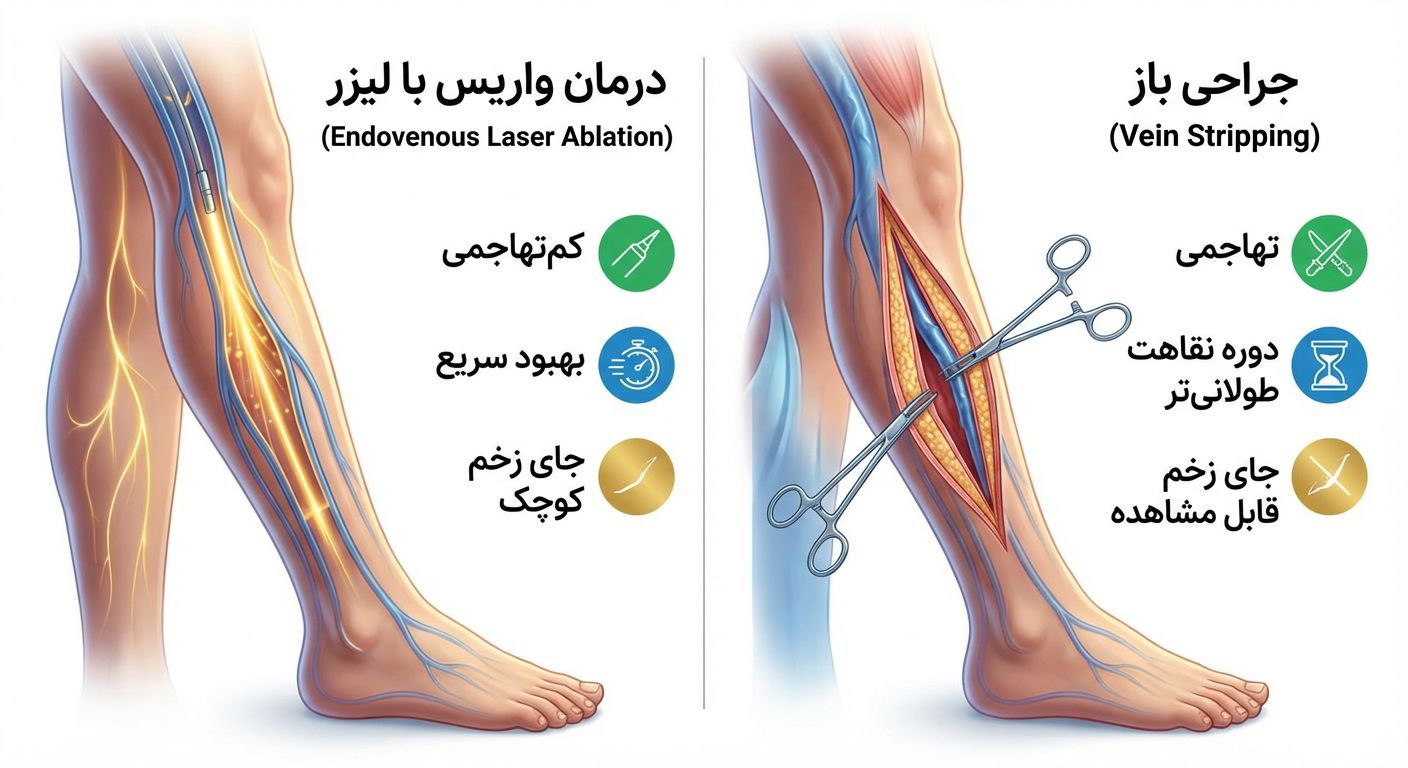 تفاوت درمان واریس با لیزر و جراحی باز