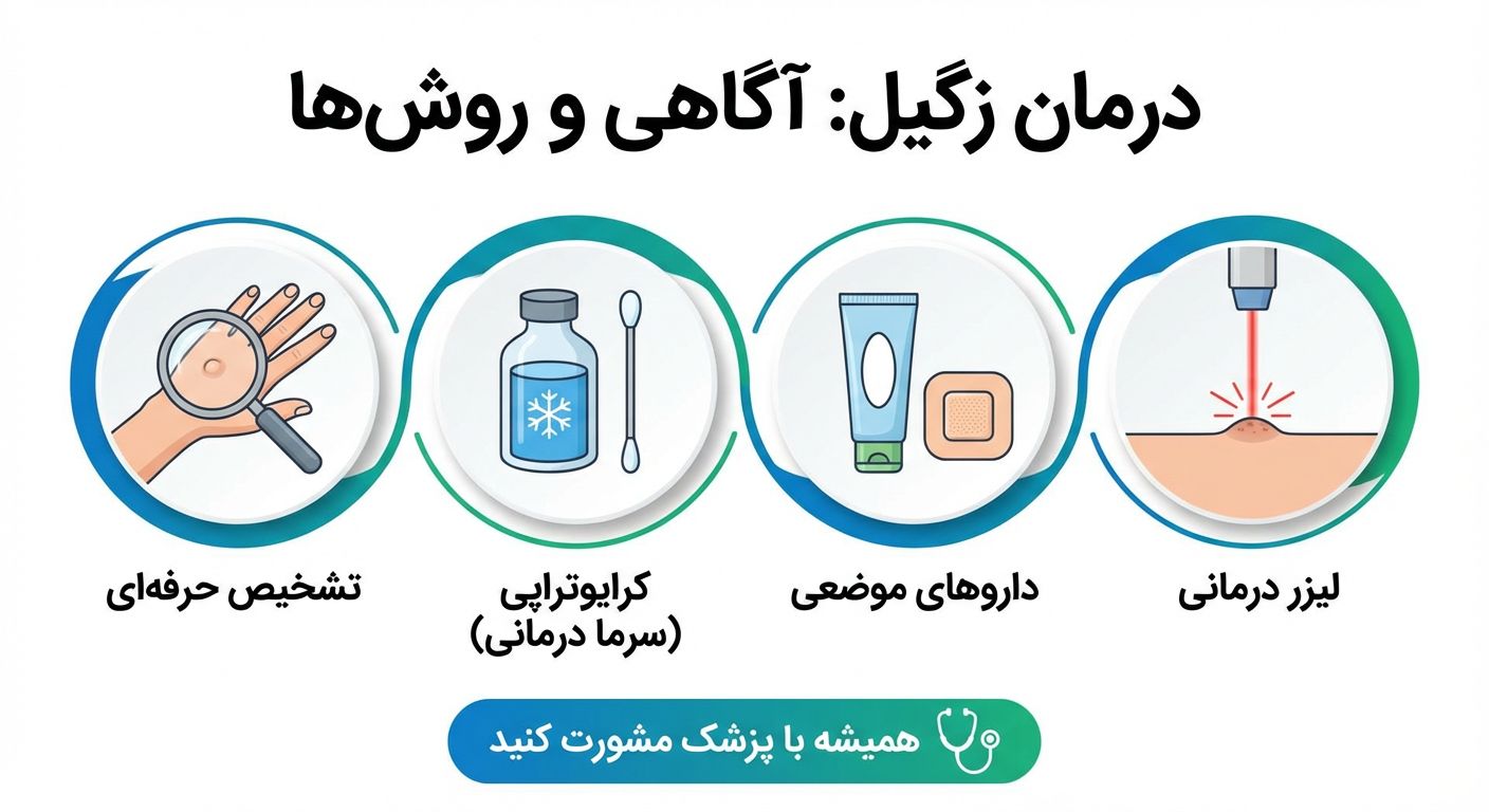 درمان زگیل
