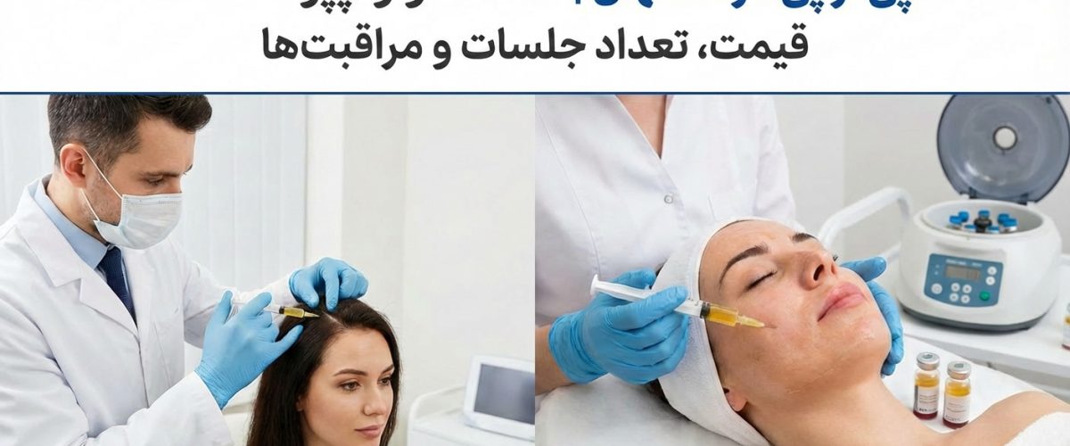پی آر پی در اصفهان | راهنمای کامل PRP مو و پوست + قیمت، تعداد جلسات و مراقبت‌ها