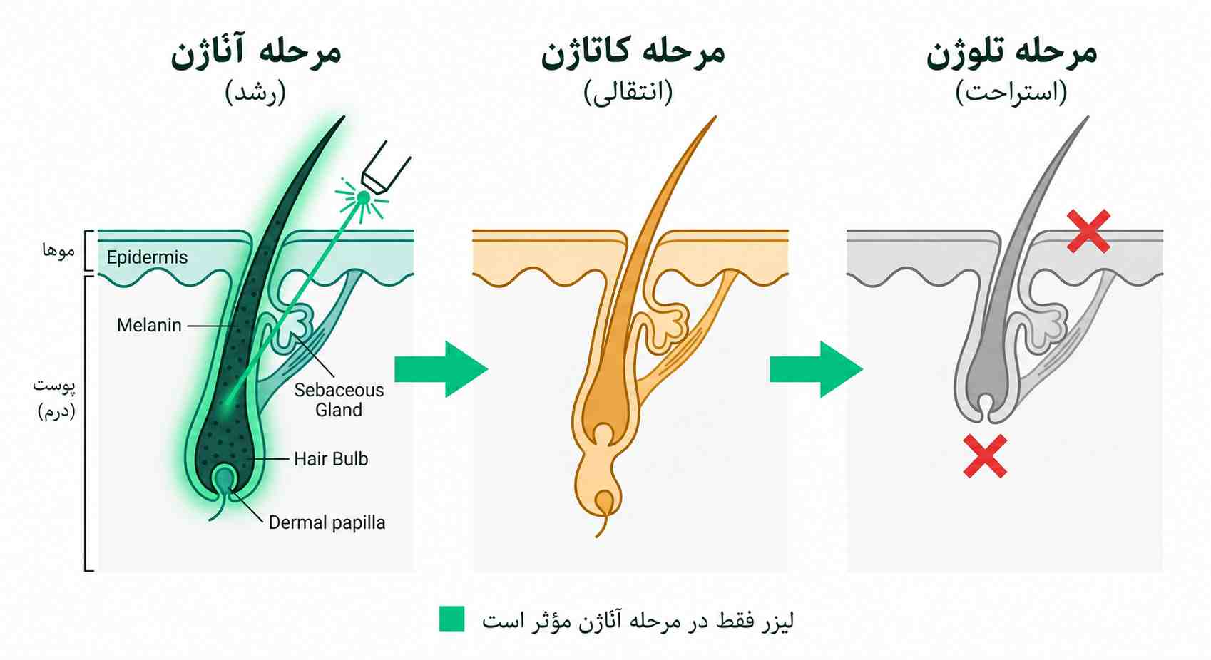 سه فاز چرخه رشد مو آناژن، کاتاژن و تلوژن و اثربخشی لیزر موهای زائد صورت فقط در فاز آناژن