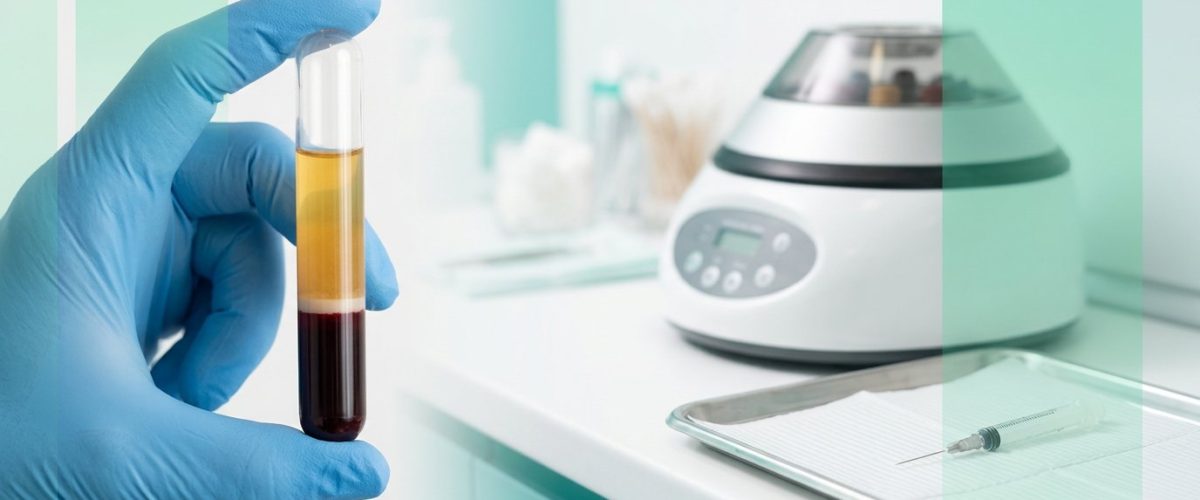 عوارض تزریق PRP و لوله خون سانتریفیوژ شده با سه لایه پلاسما، بافی‌کوت و گلبول قرمز در کلینیک دکتر ساقی فاطمی اصفهان