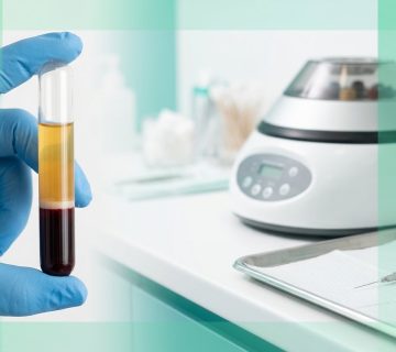 عوارض تزریق PRP و لوله خون سانتریفیوژ شده با سه لایه پلاسما، بافی‌کوت و گلبول قرمز در کلینیک دکتر ساقی فاطمی اصفهان